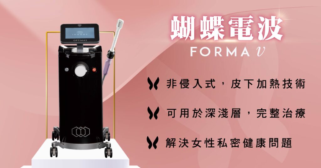 蝴蝶電波3大優勢