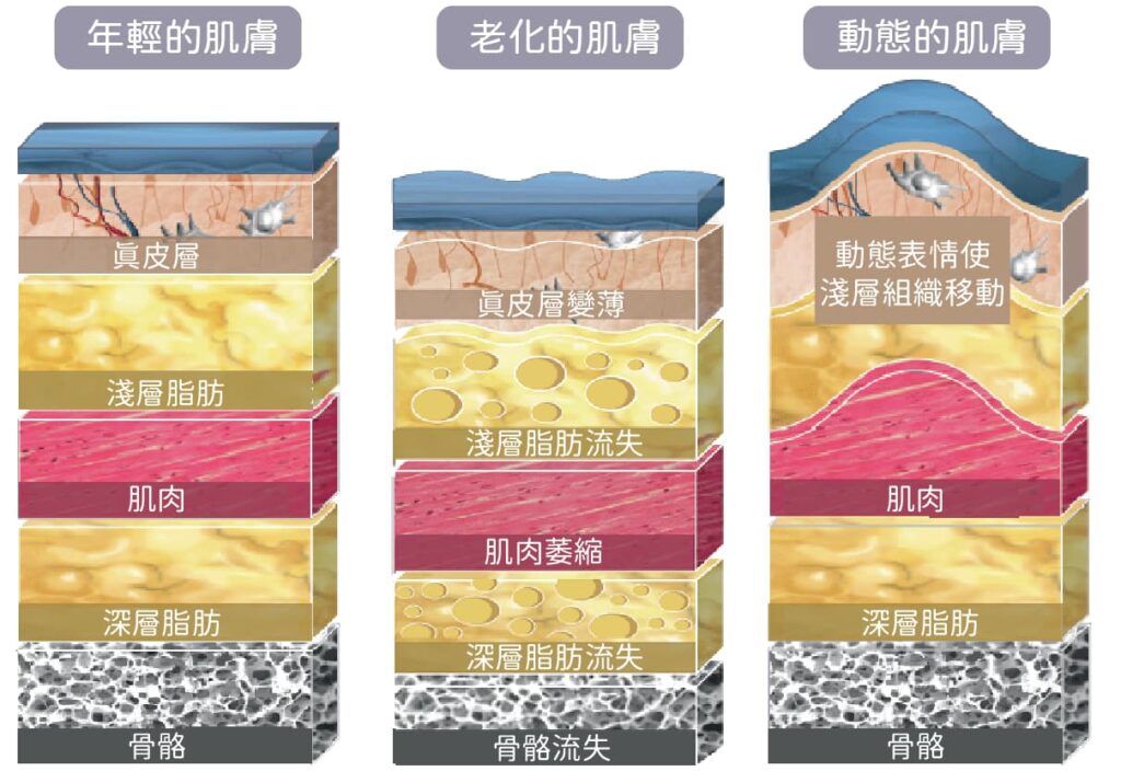TEOXANE緹奧西玻尿酸-台中醫美-緻己美學診所