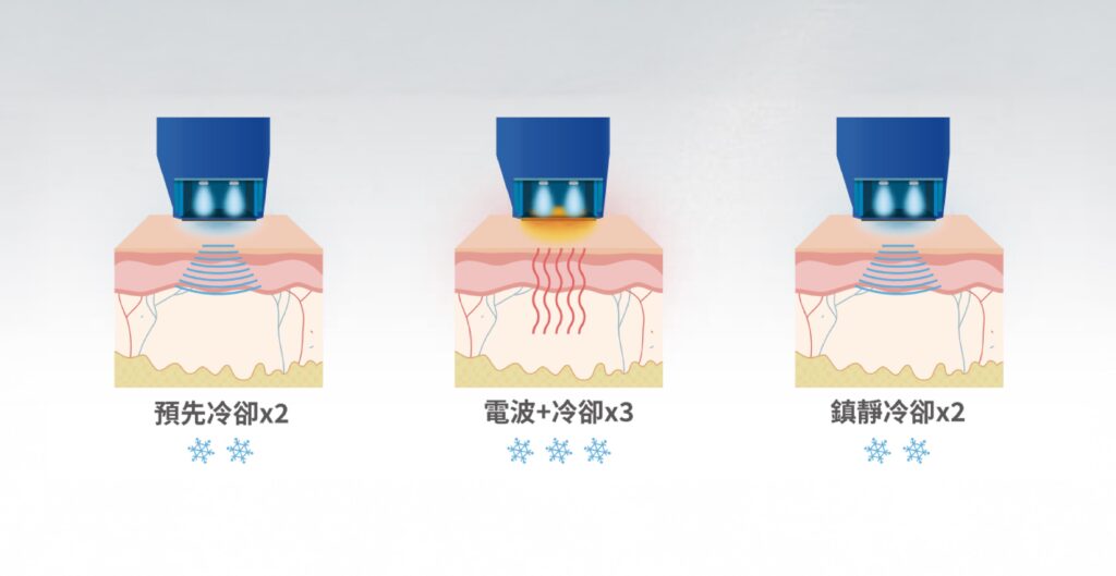 黑色十蓓電波7段冷噴技術